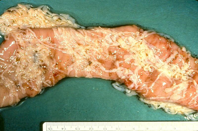 Представитель Отряда Cyclophyllidea